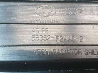 86350F2AA0, 86352F2AA0 решетка радиатора Hyundai Elantra AD Арт 258278PM, вид 9