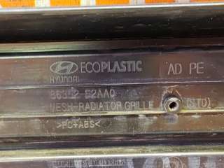 86350F2AA0, 86352F2AA0 решетка радиатора Hyundai Elantra AD Арт 272389PM, вид 11